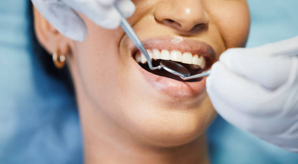 Best Walk-In Emergency Dentist in Pimmit Hills, VA