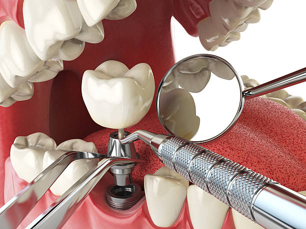 Best Weekend Emergency Dentist in Pimmit Hills, VA